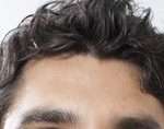 Regrow your hair