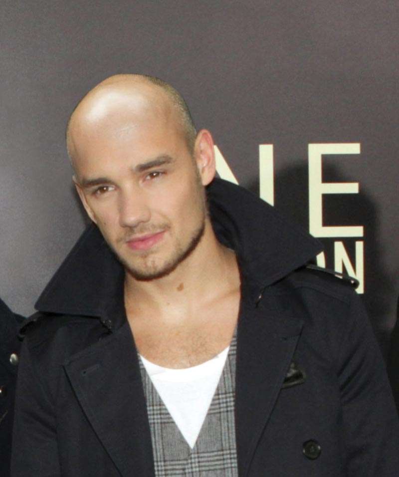 Liam Payne bald losing hair loss