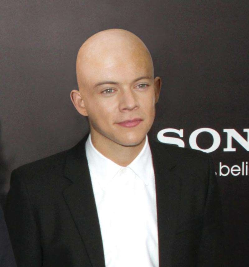 Harry Styles bald with no hair loss