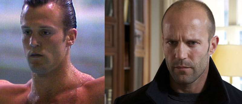 Jason Statham before and after hair loss
